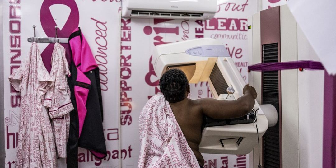 Mammografia nie jest zakazana w Szwajcarii - Featured image